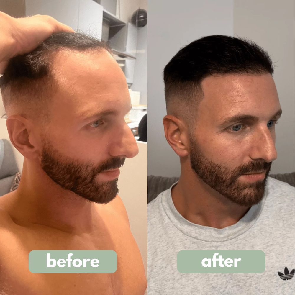 Growly - Hair growth serum