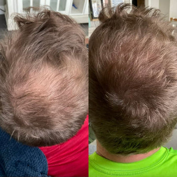 "Unlock Your Hair's True Radiance Today!"